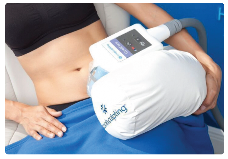 What is Coolsculpt?